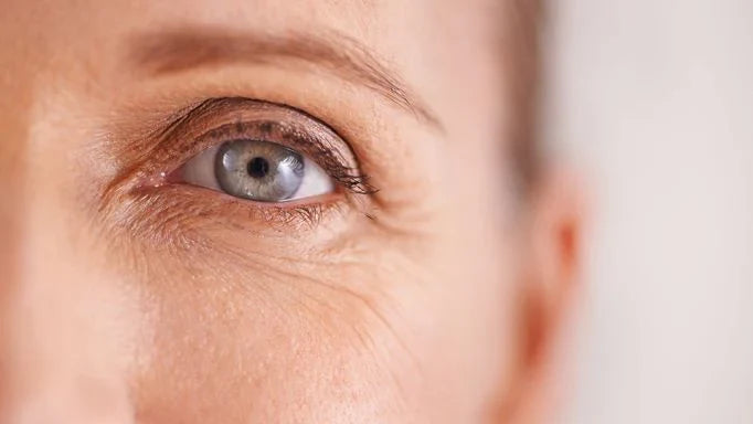The Ultimate Guide to Reducing Fine Lines Under Eyes