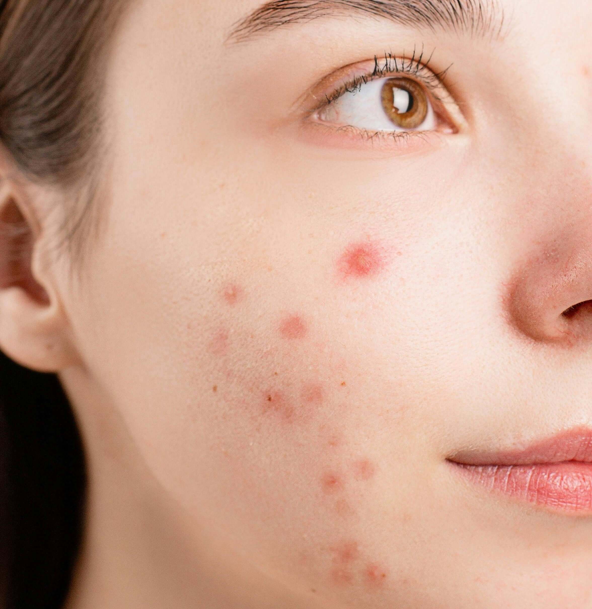 Best Skincare Products for Sensitive Skin