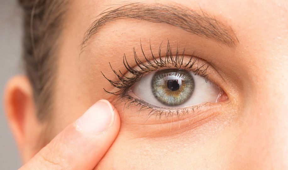 Eye Wrinkles